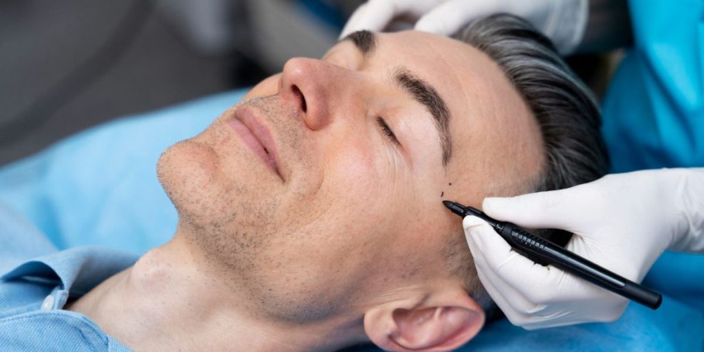Non-Surgical Skin Tightening vs. Surgery: Why More People Are Choosing the Non-Invasive Option